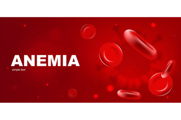 Anemia Realistic Vector Banner Template: A Comprehensive Guide for Hematology Professionals